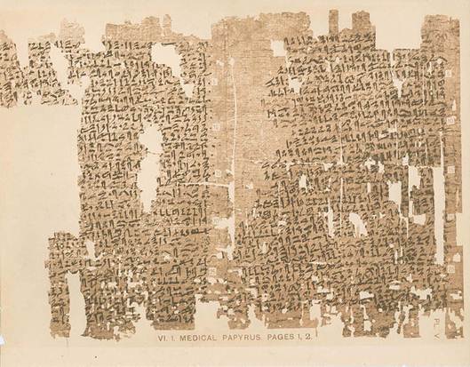 Gynekologick papyrus z Khunu